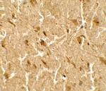 USP25 Polyclonal Antibody