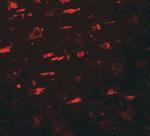 ULK4 Antibody in Immunohistochemistry (Paraffin) (IHC (P))