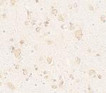 ULK4 Polyclonal Antibody