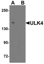 ULK4 Antibody in Western Blot (WB)