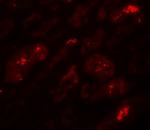 BATF3 Antibody in Immunohistochemistry (IHC)