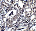 BATF3 Polyclonal Antibody