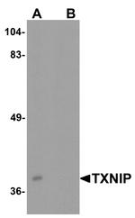 BATF3 Antibody in Western Blot (WB)