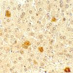 PDCL3 Polyclonal Antibody