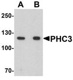 PHC3 Polyclonal Antibody