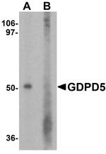 GDPD5 Antibody in Western Blot (WB)