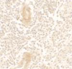IL1F10 Polyclonal Antibody