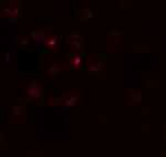 RSPO3 Polyclonal Antibody