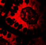 Treslin Antibody in Immunohistochemistry (Paraffin) (IHC (P))