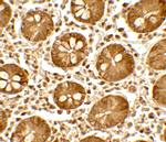 Treslin Polyclonal Antibody