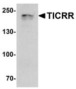 Treslin Antibody in Western Blot (WB)