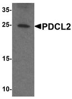 PDCL2 Polyclonal Antibody