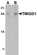TMIGD1 Antibody in Western Blot (WB)