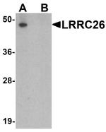 LRRC26 Antibody in Western Blot (WB)