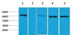 ZBTB45 Antibody in Western Blot (WB)