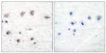 Phospho-alpha Adducin (Ser726) Antibody in Immunohistochemistry (Paraffin) (IHC (P))