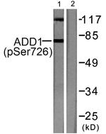 Phospho-alpha Adducin (Ser726) Antibody in Western Blot (WB)