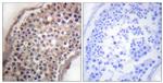 Ephrin B1/B3 Antibody in Immunohistochemistry (Paraffin) (IHC (P))