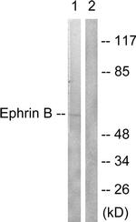 Ephrin B1/B3 Antibody in Western Blot (WB)