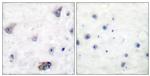 Phospho-GABRB1 (Ser434) Antibody in Immunohistochemistry (Paraffin) (IHC (P))