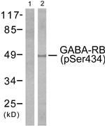 Phospho-GABRB1 (Ser434) Antibody in Western Blot (WB)