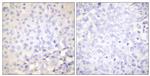 Phospho-IkB epsilon (Ser22) Antibody in Immunohistochemistry (Paraffin) (IHC (P))