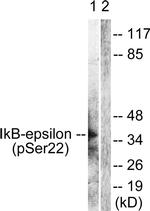 Phospho-IkB epsilon (Ser22) Antibody in Western Blot (WB)
