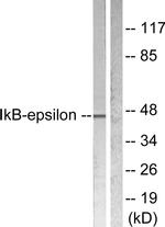 IkB epsilon Antibody in Western Blot (WB)