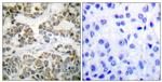 Phospho-SHC (Tyr349) Antibody in Immunohistochemistry (Paraffin) (IHC (P))