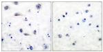 Phospho-TrkB (Tyr515) Antibody in Immunohistochemistry (Paraffin) (IHC (P))