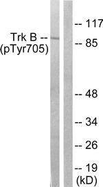Phospho-TrkB (Tyr705) Antibody in Western Blot (WB)