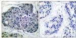 Phospho-Acetyl-CoA Carboxylase (Ser80) Antibody in Immunohistochemistry (Paraffin) (IHC (P))