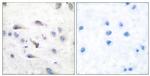 Phospho-TPL2 (Thr290) Antibody in Immunohistochemistry (Paraffin) (IHC (P))