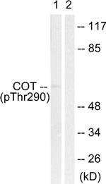 Phospho-TPL2 (Thr290) Antibody in Western Blot (WB)