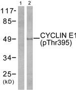 Phospho-Cyclin E (Thr395) Antibody in Western Blot (WB)