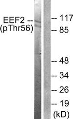 Phospho-EEF2 (Thr56) Antibody in Western Blot (WB)