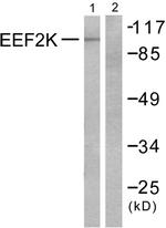 EEF2K Antibody in Western Blot (WB)