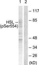 Phospho-HSL (Ser554, Ser855) Antibody in Western Blot (WB)