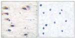 Phospho-KSR1 (Ser392) Antibody in Immunohistochemistry (Paraffin) (IHC (P))