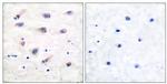 Phospho-PLCB3 (Ser1105) Antibody in Immunohistochemistry (Paraffin) (IHC (P))