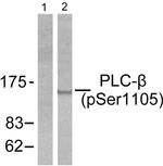 Phospho-PLCB3 (Ser1105) Antibody in Western Blot (WB)