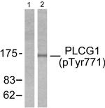 Phospho-PLCG1 (Tyr771) Antibody in Western Blot (WB)