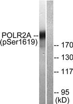 Phospho-POLR2A (Ser1619) Antibody in Western Blot (WB)