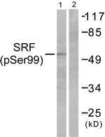 Phospho-SRF (Ser99) Antibody in Western Blot (WB)