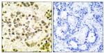 Phospho-STAT5 beta (Ser731) Antibody in Immunohistochemistry (Paraffin) (IHC (P))