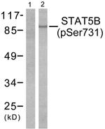 Phospho-STAT5 beta (Ser731) Antibody in Western Blot (WB)