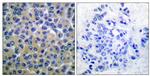 Phospho-Syk (Tyr348) Antibody in Immunohistochemistry (Paraffin) (IHC (P))