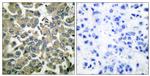 Phospho-WNK1 (Thr58) Antibody in Immunohistochemistry (Paraffin) (IHC (P))