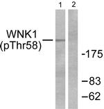 Phospho-WNK1 (Thr58) Antibody in Western Blot (WB)