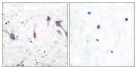 ARC Antibody in Immunohistochemistry (Paraffin) (IHC (P))